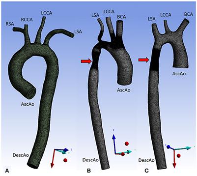 4DFlowNet: Super-Resolution 4D Flow MRI Using Deep Learning and Computational Fluid Dynamics